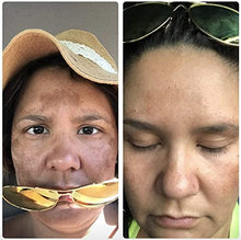 Load image into Gallery viewer, Potent Dark Spot Corrector Remover For Face & Retinol Cream Provides the Most Effective Combination For Fading & Removing Dark Spots