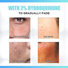 Load image into Gallery viewer, 2% Hydroquinone Dark Spot Corrector Whitening Cream, Skin Bleaching Cream Lightening Cream Hyperpigmentation Melasma Treatment with Kojic Acid, Alpha Arbutin, Salicylic Acid, Niacinamide, Azelaic Acid