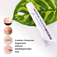 Load image into Gallery viewer, AZALLY Advanced Scar Gel - Scar Diminishing Serum - Reduces the Appearance of Old & New Scars - Best Scar Treatment for Repair Scars from Burns Cuts Acne Spots Stretch Marks - 1oz.