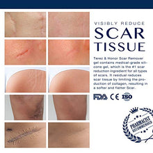 Load image into Gallery viewer, Scar Remover Gel for Scars from C-Section, Stretch Marks, Acne, Surgery, Effective for both Old and New Scars
