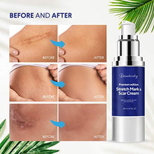 Load image into Gallery viewer, Beautivity Scar Cream, Advanced Scar Treatment, Premium Edition Stretch Mark & Scar Cream, Acne, Surgery, Stretch Marks, Stretch Marks Relief and Burns Repair, Face Skin Repair Gel Made in Canada