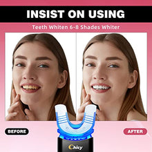 Load image into Gallery viewer, CHICY Teeth Whitening Kit with LED Light Technology Upgrade,Cooperate with New Carbamide Peroxide Teeth Whitening Gel 6X5ml, 5X Faster Than Whitening Strips,Effectively Remove All Kinds of Stain