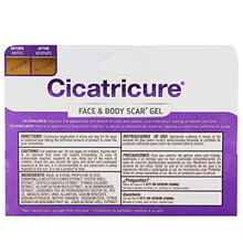 Load image into Gallery viewer, Cicatricure Face & Body Scar Gel, 1 Ounce