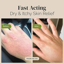 Load image into Gallery viewer, Puriya National Eczema Association Accepted Cream, Dry Itchy Skin Relief, Colloidal Oatmeal Lotion, Gentle on Kids, Adults, Face, Hands, Mother of All Creams, Plant-Based Hydration, No Fragrance Added