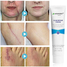 Load image into Gallery viewer, Scar Removal Cream, Scar Cream, Stretch Mark Cream, Natural Formula, Scar Gel Medical-Grade Silicone for Face, Body, C-Sections, Surgical, Burn, Acne Spots, Old & New Scars, 20g