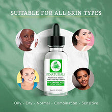 Load image into Gallery viewer, OZNaturals Hyaluronic Acid and Vitamin C Serum - Moisturizing and Anti Aging Serum For Face With Pure Vitamin E Oil and Rosehip Oil - Best Anti Wrinkle and Pore Minimizer Facial Serum - 1 Fl Oz