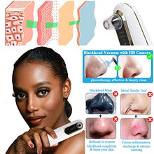 Load image into Gallery viewer, Blackhead Remover Pore Vacuum with Camera – DoVis Electric Visible Blackhead Vacume Remover Rechargeable Face Acne Comedo Pore Cleaner Extractor Blackhead Suction Tool Device for Women Men, White