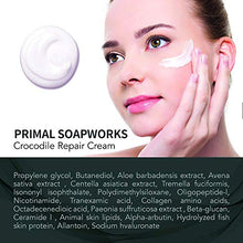 Load image into Gallery viewer, Scar Removal Cream For Old Scars -Stretch Mark Removal Cream for Men and Women Stretch Marks Relief and Burns Repair,Face Skin Repair Cream