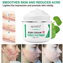Load image into Gallery viewer, Scar Remover Cream, Reduce and Repair Skin, from C-Section, Acne, Surgery, Burns, Face Sacne, Effective for both Old and New Scars, Best Scar Removal Cream for Kids, Women, Men, 50Ml