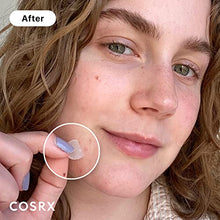 Load image into Gallery viewer, COSRX Acne Pimple Patch (96 Counts) Absorbing Hydrocolloid Original 3 Size Patches for Blemishes and Zits Cover, Spot Stickers for Face and Body, Not Tested on Animals, No Toxic Ingredients