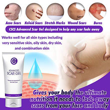 Load image into Gallery viewer, CSCS Most Effective Scar Remover Cream with Hydrolyzed Collagen & Vitamin E - Heals Old & New Scars from Cuts, Acne, Stretch Marks, Burns & Post Surgeries Scars - Fast Results, for All Skin Types 2 oz