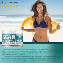 Load image into Gallery viewer, Scar Removal Cream - Effective Stretch Mark Removal - Natural Skin Repair - Acne Scar Remover Cream - Made in USA - Advanced Treatment for Old Scars & Acne Scars - Clinically Proven Formula - 2 OZ