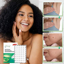 Load image into Gallery viewer, Best Skin Tag Remover and Acne Patch- Falls Away and Dries, All-Natural Ingredients,Newly Improved Formula- Easy and Effective