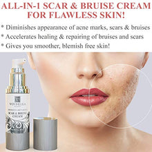 Load image into Gallery viewer, Scar & Bruise Removal Cream - Best Treatment Remedy for Healing, Skin Repair, Fading & Prevention of Old or New Acne & Stretch Mark, Surgical, Keloid, C Section, Pregnancy or Bug Bite Scars & Bruises