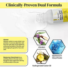 Load image into Gallery viewer, Milia Remover Milia Spot Treatment Helps Dissolve and Reduce Milia in 4 weeks with natural ingredients 0.5 oz by SUNHEAL