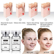Load image into Gallery viewer, Facial Serum, Acne Scar Treatment, Face Essence, Scar Fade Serum, Moisturizing Serum, Acne Treatment Serum, Moisturizing and Hydrating, Anti-Wrinkle,Anti-Aging,Firm and Lift Skin,Remove Acne, Scar