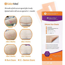 Load image into Gallery viewer, Silicone Scar Sheet, Scar Away, Scar Removal Treatment Sheet, 5.9'' x 1.6'',5 Pack, for Hypertrophic Scar,Keloid Scar,C-section Scar,Surgery Scar,Burn Scar, Acne Scar Removal Treatment by Ealionmed