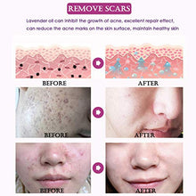 Load image into Gallery viewer, Taykoo Scar Repair Skin Essential Oil Lavender Essence Skin Care Natural Pure Remove Ance Burn Strentch Marks Scar Removal