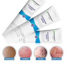 Load image into Gallery viewer, Scar Removal Cream, Scar Cream, Stretch Mark Cream, Natural Formula, Scar Gel Medical-Grade Silicone for Face, Body, C-Sections, Surgical, Burn, Acne Spots, Old & New Scars, 20g