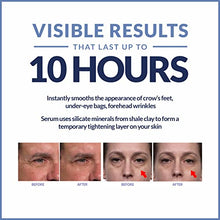 Load image into Gallery viewer, Plexaderm Rapid Reduction Eye Serum - Advanced Formula - Anti Aging Serum Visibly Reduces Under-Eye Bags, Wrinkles, Dark Circles, Fine Lines & Crow's Feet Instantly - Instant Wrinkle Remover for Face