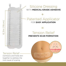 Load image into Gallery viewer, Embrace Active Scar Defense for New Scars, FDA-Cleared Silicone Scar Sheets (Size Medium (2.4 Inch)) 60 Day Supply, Pack of 2