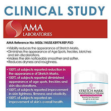 Load image into Gallery viewer, Stretch Mark Cream for Pregnancy & Scar Removal - 100% Retinol Free - Mommy Knows Best Maternity Stretch Marks Cream Removal Treatment with Cocoa and Shea Butter - Clinically Proven - 4 fl oz