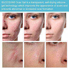 Load image into Gallery viewer, Scar Removal Cream, Scar Cream, Stretch Mark Cream, Natural Formula, Scar Gel Medical-Grade Silicone for Face, Body, C-Sections, Surgical, Burn, Acne Spots, Old & New Scars, 20g