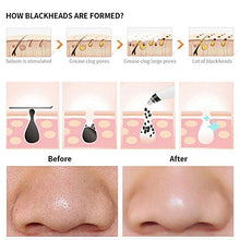 Load image into Gallery viewer, Blackhead Remover,Zdatt Blackhead Vacume Remover -Comedo Pore Extracotr Beauty Device with 5 Probes for Blackhead Remover Vacume Suction Cleanser