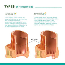 Load image into Gallery viewer, Reejoys Hemorrhoid Cream, Hemorrhoid Treatment, Hemorrhoid & Fissure Ointment, Fast Relief Hemorrhoid Cream Healing Formula, Hemorrhoid Symptom Ointment… (0.9 oz)