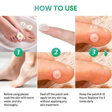 Load image into Gallery viewer, Best Skin Tag Remover and Acne Patch- Falls Away and Dries, All-Natural Ingredients,Newly Improved Formula- Easy and Effective