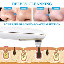 Load image into Gallery viewer, Blackhead Remover Pore Vacuum with Camera – DoVis Electric Visible Blackhead Vacume Remover Rechargeable Face Acne Comedo Pore Cleaner Extractor Blackhead Suction Tool Device for Women Men, White