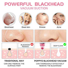 Load image into Gallery viewer, Blackhead Remover Pore Vacuum - Electric Blackhead Vacuum Cleaner Blackhead Extractor Tool Device Comedo Removal Suction Beauty Device for Women(Pink)