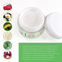 Load image into Gallery viewer, Scar Removal Cream - Advanced Treatment for Face & Body, Old & New Scars from Cuts, Stretch Marks, C-Sections & Surgeries - With Natural Herbal Extracts Formula