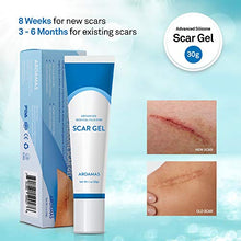 Load image into Gallery viewer, Aroamas Silicone Scar Gel, 30g, Silicone Scar Gel for Surgical Scars, for Face, Scar Gel with Silicone for Keloids, C-Section, Cosmetic Procedures, Burns, Injuries