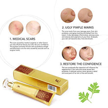Load image into Gallery viewer, Scar Removal Cream For Old Scars- Stretch Mark Removal Gel for Men & Women- Stretch Marks Relief and Burns Repair,Face Skin Repair Gel
