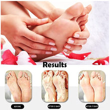 Load image into Gallery viewer, STRIDE Foot Cream Smoothes Rough & Dry Skin –– Dematologist-Developed, Intensely Moisturizing Foot Cream with Aloe Vera, Coconut oil and Green tea