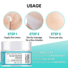Load image into Gallery viewer, Scar Removal Cream, Scar Cream For Old Scars - Stretch Mark Removal Cream for Men & Women - Stretch Marks Relief and Burns Repair, Face Skin Repair Cream