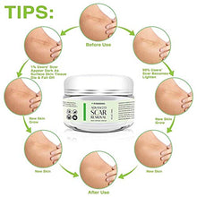 Load image into Gallery viewer, Scar Removal Cream - Advanced Treatment for Face & Body, Old & New Scars from Cuts, Stretch Marks, C-Sections & Surgeries - With Natural Herbal Extracts Formula