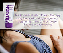 Load image into Gallery viewer, Mederma Stretch Marks Therapy - Hydrates to Help Prevent Stretch Marks - Clinically Shown to Produce Noticable Improvement in 4 Weeks- Dermatologist Recommended - 5.29 oz, Ivory (MERZ429530)