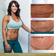 Load image into Gallery viewer, Embrace Active Scar Defense for New Scars, FDA-Cleared Silicone Scar Sheets (Size Medium (2.4 Inch)) 60 Day Supply, Pack of 2