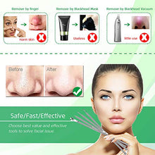 Load image into Gallery viewer, 5PCS Blackhead Remover Comedone Extractor, Curved Blackhead Tweezers Kit, Professional Stainless Pimple Acne Blemish Removal Tools Kit