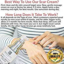 Load image into Gallery viewer, Scar & Bruise Removal Cream - Best Treatment Remedy for Healing, Skin Repair, Fading & Prevention of Old or New Acne & Stretch Mark, Surgical, Keloid, C Section, Pregnancy or Bug Bite Scars & Bruises