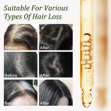 Load image into Gallery viewer, Gypsophila Batana Oil for Hair Growth -100% Pure Natural Hair Growth Oil, Nourishes The Scalp, Eliminates Split Ends, Reduce Hair Loss &amp; Detox Your Scalp (2 Pack) for All Hair Types

