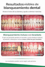 Load image into Gallery viewer, Opalescence Go 15% Mint - Prefilled Teeth Whitening Trays - 15% Hydrogen Peroxide - (10 Treatments) Made by Ultradent Products. Teeth Whitening Kit -Mint - Includes 2Chill Toothbrush 5194-1T
