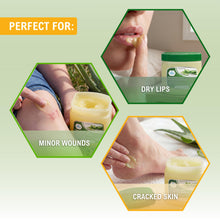 Load image into Gallery viewer, MED PRIDE Petroleum Jelly with Aloe Vera &amp; Vitamin E, 13 oz – Skin Protectant and Moisturizing Ointment for Dry or Irritated Skin, Rashes, Chapped Lips, Minor Cuts, Burns and Diaper Rash
