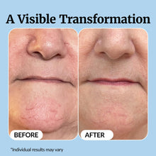 Load image into Gallery viewer, Vibriance Super C Serum for Mature Skin - All-in-One Vitamin Formula Hydrates, Firms, Lifts, Smooths, Targets Age Spots, Wrinkles, 1 fl oz
