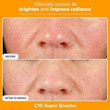 Load image into Gallery viewer, Paula's Choice Brighter Days Ahead Kit, Vitamin C and AHA Trio, Includes Travel Size C5 SPF Face Sunscreen, Mandelic Acid Exfoliant, C15 Vitamin C Booster Serum, Brightening &amp; Resurfacing, 3-Piece Set
