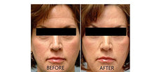 Load image into Gallery viewer, Vitamin C Serum 20% Pure L-Ascorbic Acid, Ferulic Acid, Vitamin E and Hyaluronic Acid for Face and Eyes Natural Anti Aging Anti Wrinkle 1oz. by Dr. Brenner (1 oz)
