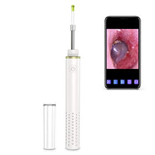 Load image into Gallery viewer, Ear Specula Set for ScopeAround/Anykit Digital Otoscope Ear Wax Removal Camera, Bag of 100 Pices
