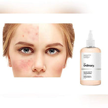 Load image into Gallery viewer, The Ordinary Glycolic Acid 7% Toning Solution 240ml

